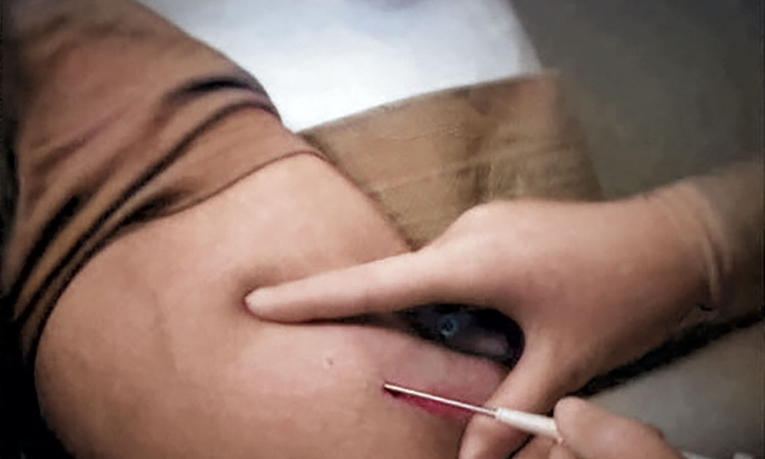 Arm with syringe inserted